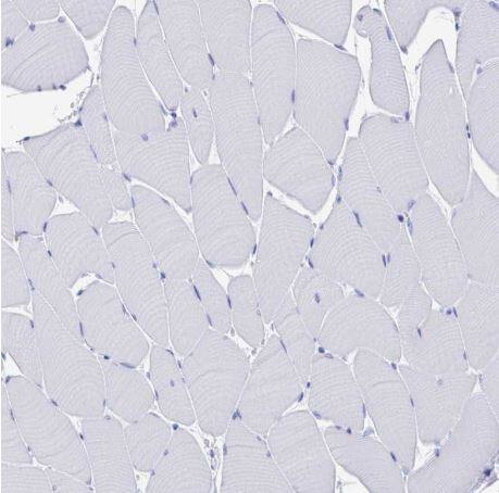 Fc gamma RIIIA/CD16a Antibody
