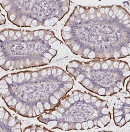 FGFR1 Antibody - BSA Free