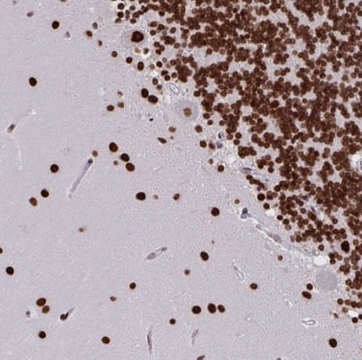 CLP1/HEAB Antibody - BSA Free