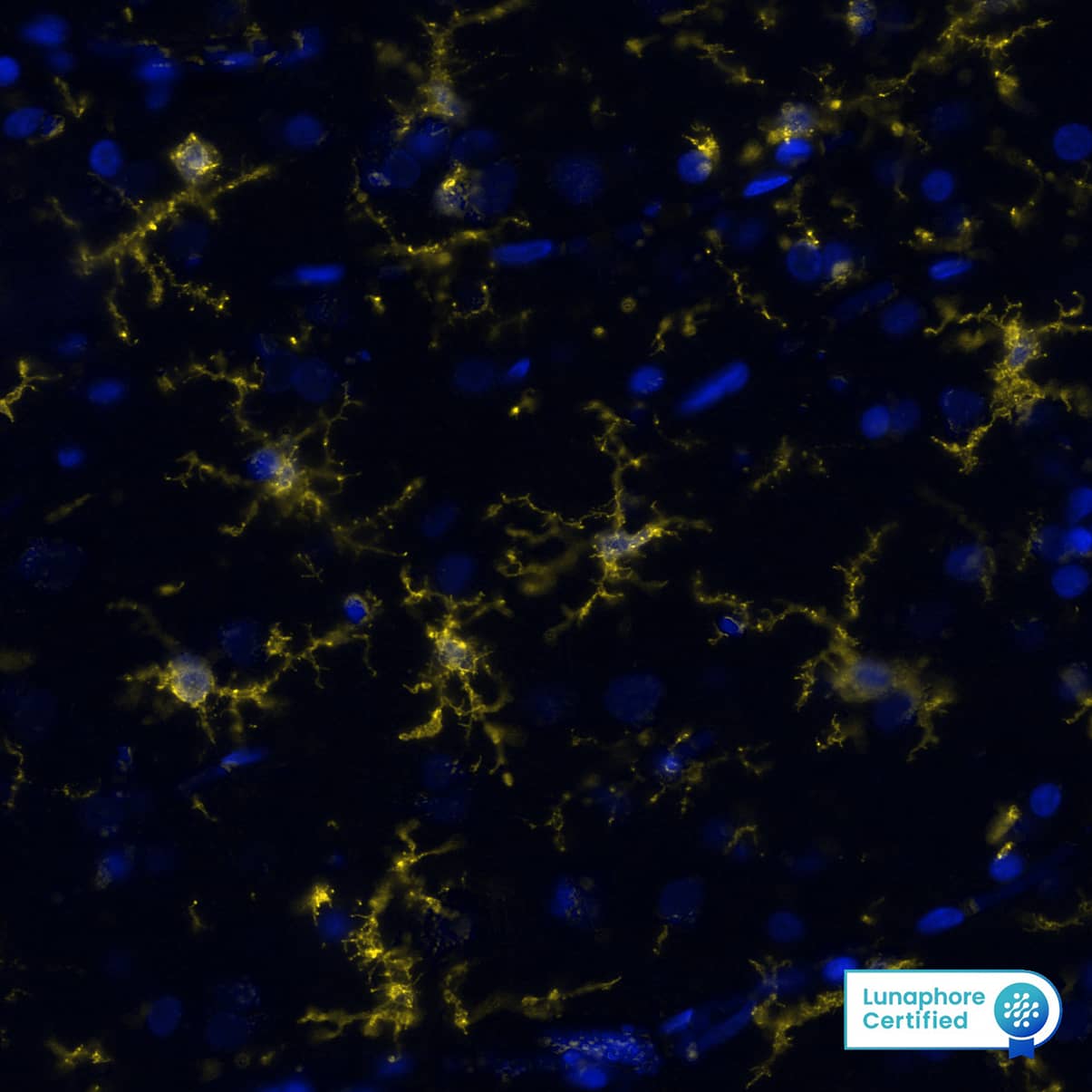 P2Y12/P2RY12 Antibody - BSA Free Detection of P2Y12/P2RY12 in human Brain Cortex via seqIF™ staining on COMET™