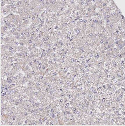 CIZ1 Antibody