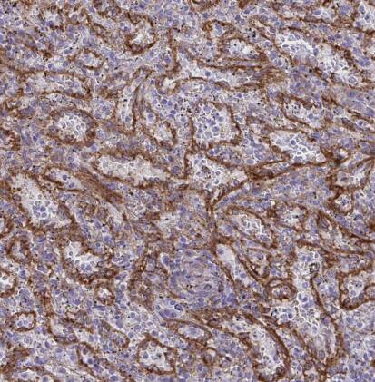 PITPNM3 Antibody