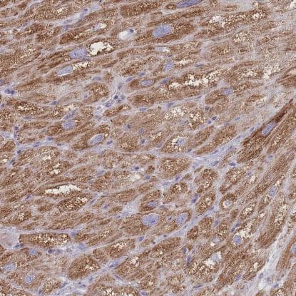 Pyruvate Dehydrogenase E1-alpha subunit Antibody