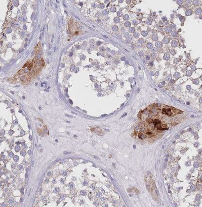 Pyruvate Dehydrogenase E1-alpha subunit Antibody