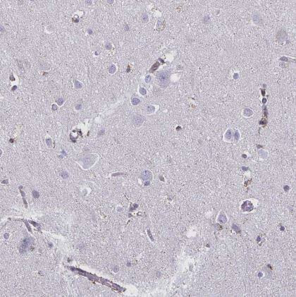 Thyrotropin Releasing Hormone Antibody