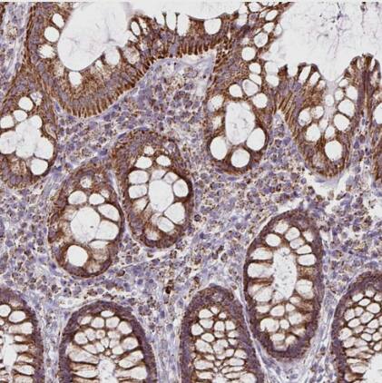 Pyruvate Dehydrogenase E2 Antibody - BSA Free