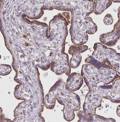Pyruvate Dehydrogenase E2 Antibody - BSA Free
