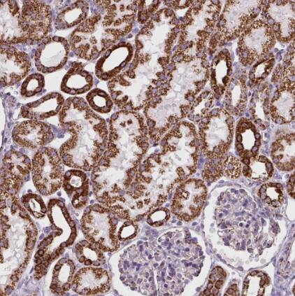 Pyruvate Dehydrogenase E2 Antibody - BSA Free