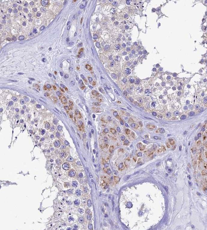 REEP4 Antibody - BSA Free