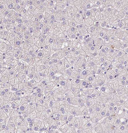 S100A7L2 Antibody