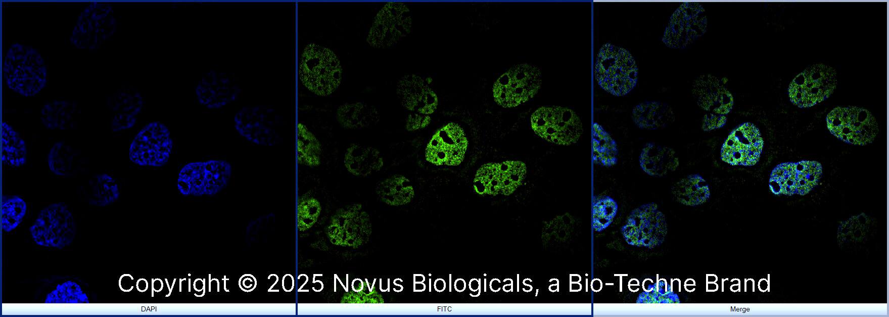 hnRNP C1 + C2 Antibody (CL2593) - BSA Free