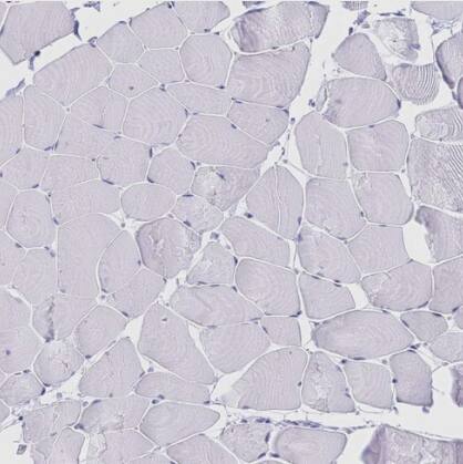 Meprin beta Subunit/MEP1B Antibody - BSA Free