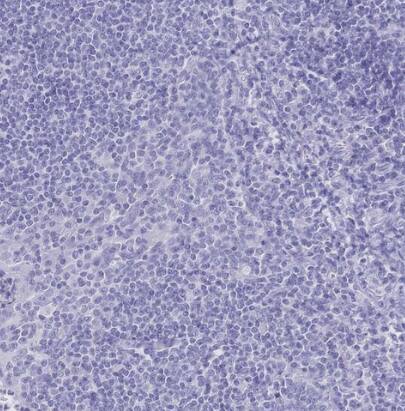 Meprin beta Subunit/MEP1B Antibody - BSA Free