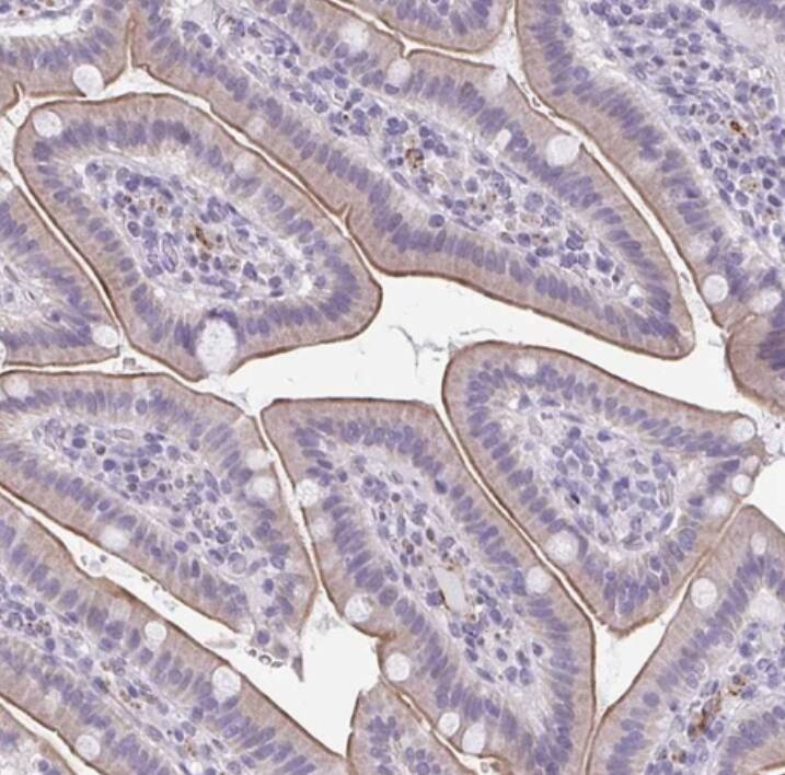 TMEM92 Antibody - BSA Free