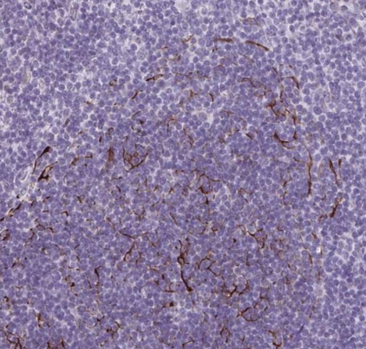 TMEM92 Antibody - BSA Free