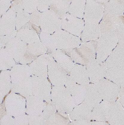 IGFBP-4 Antibody