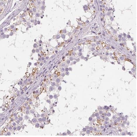 C19orf84 Antibody