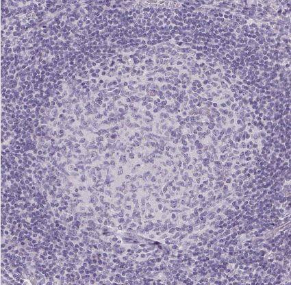 BEND2 Antibody