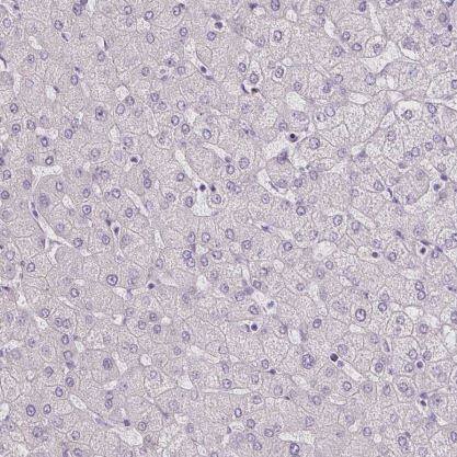 BEND2 Antibody