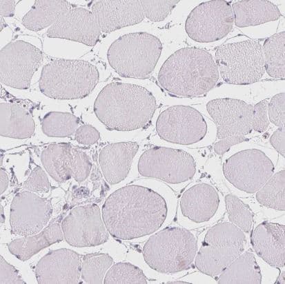 BEND2 Antibody