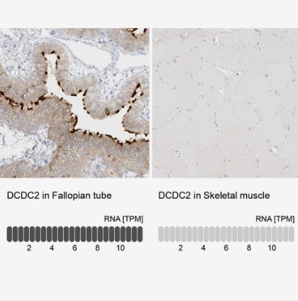 DCDC2 Antibody