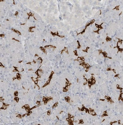 DCDC2 Antibody