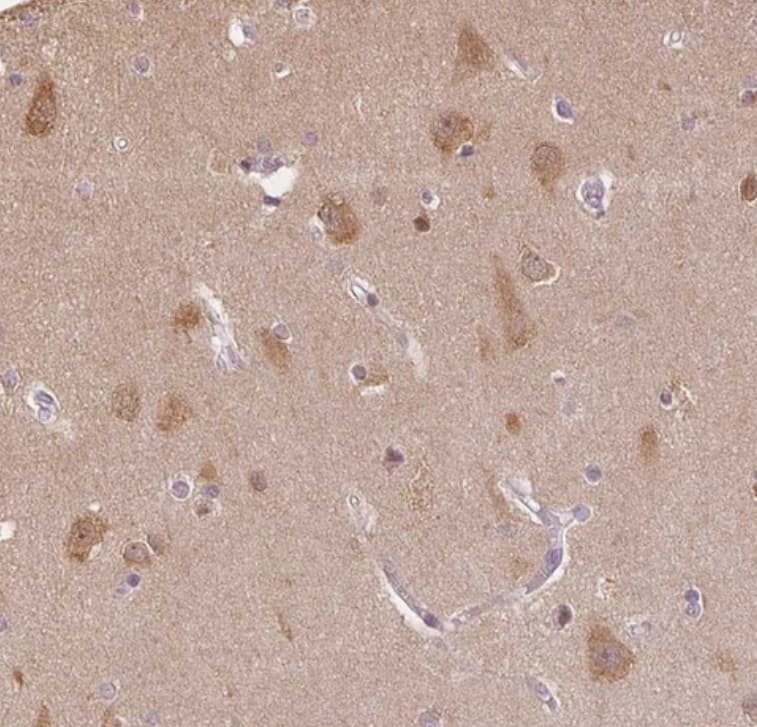 PLC-beta 1 Antibody - BSA Free