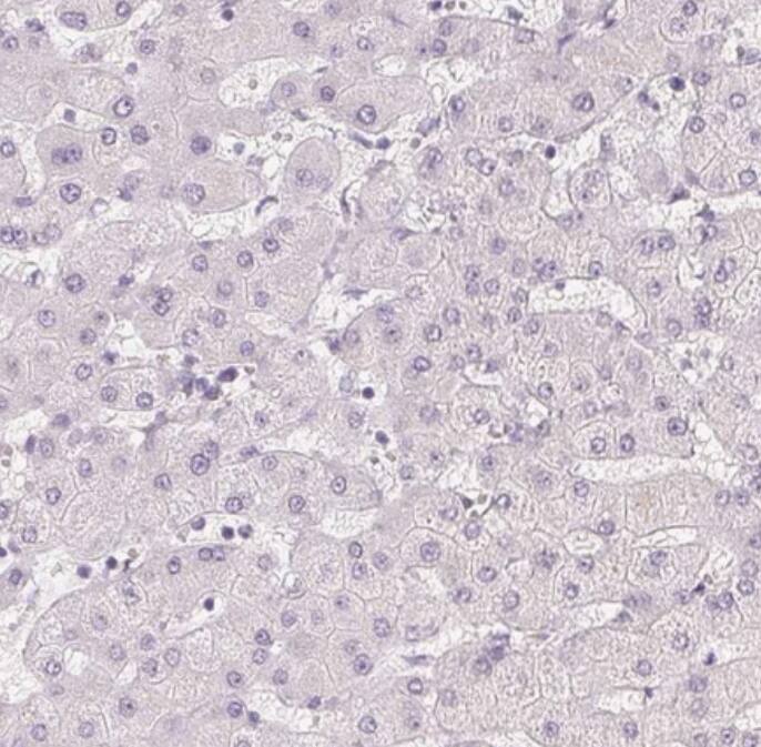 PLC-beta 1 Antibody - BSA Free