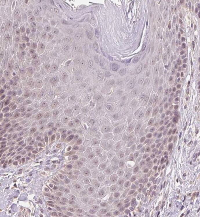 PLC-beta 1 Antibody - BSA Free