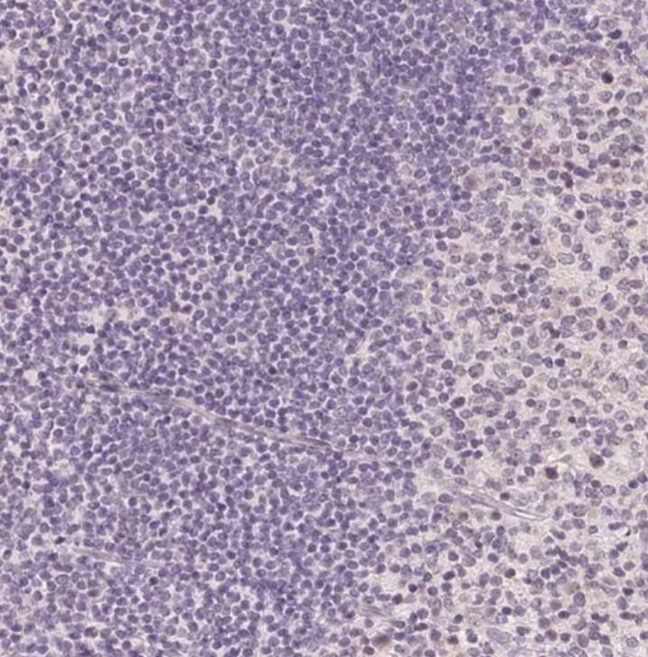 PLC-beta 1 Antibody - BSA Free