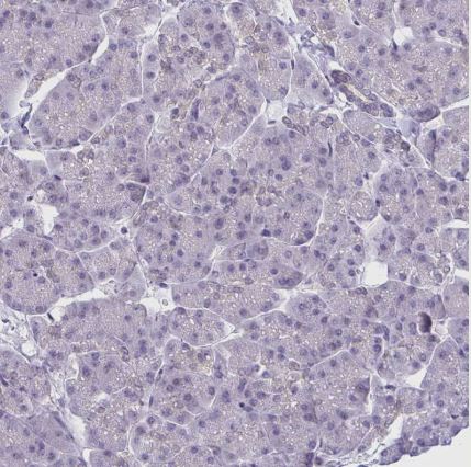 CSE1L/CAS/Exportin-2 Antibody