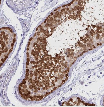 CSE1L/CAS/Exportin-2 Antibody