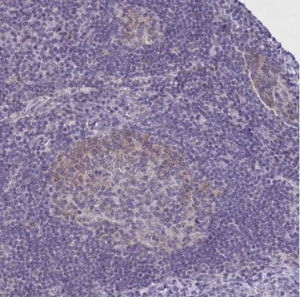 CSE1L/CAS/Exportin-2 Antibody