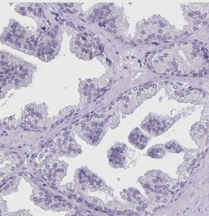 CSE1L/CAS/Exportin-2 Antibody