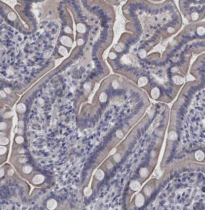 KCNB1 Antibody - BSA Free