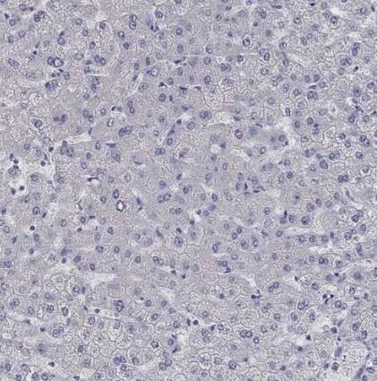 KCNB1 Antibody - BSA Free