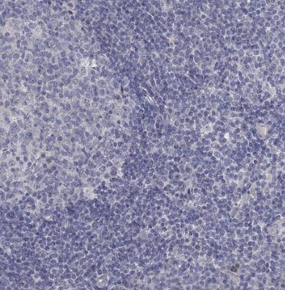 KCNB1 Antibody - BSA Free