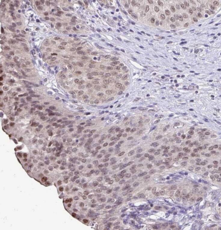 DNA Polymerase beta Antibody - BSA Free