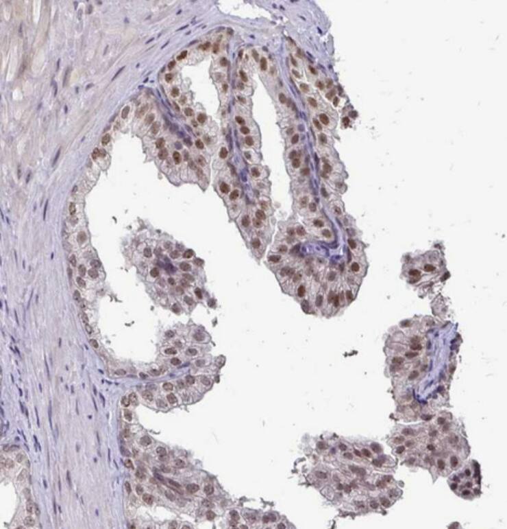 DNA Polymerase beta Antibody - BSA Free