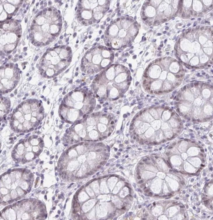 DNA Polymerase beta Antibody - BSA Free