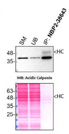 Acidic Calponin Antibody