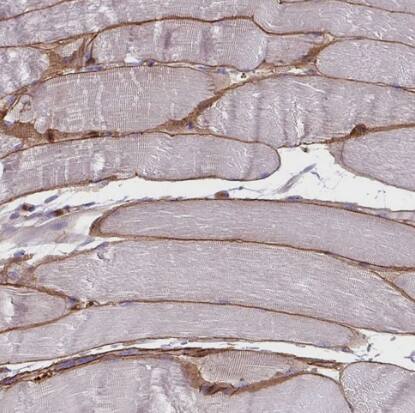 Adiponectin/Acrp30 Antibody - BSA Free