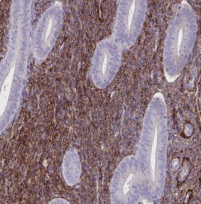 Adiponectin/Acrp30 Antibody - BSA Free