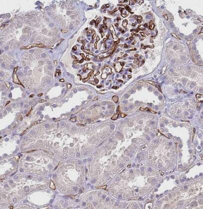 Adiponectin/Acrp30 Antibody - BSA Free