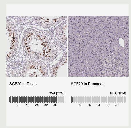 CCDC101 Antibody