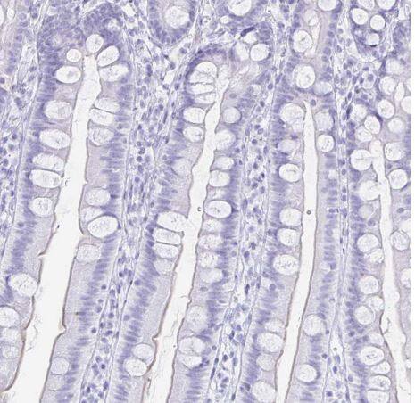 TIMP-1 Antibody