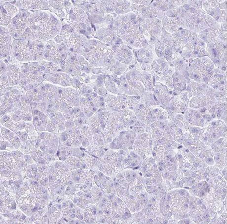 TIMP-1 Antibody