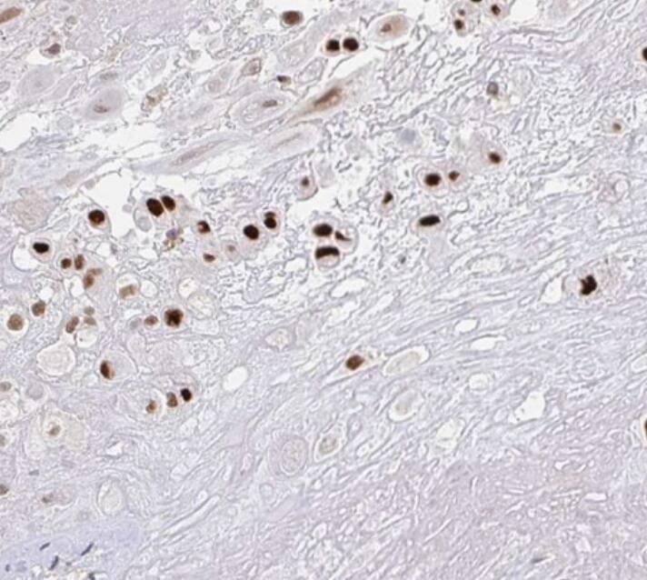 RCOR1/CoREST Antibody - BSA Free