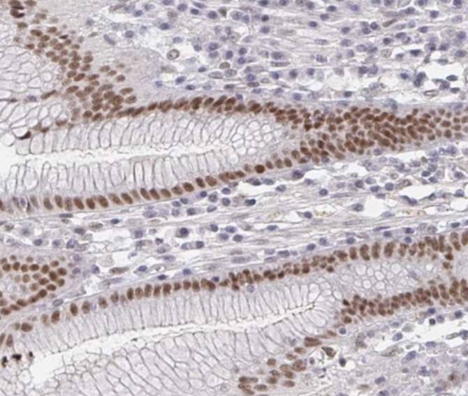 RCOR1/CoREST Antibody - BSA Free