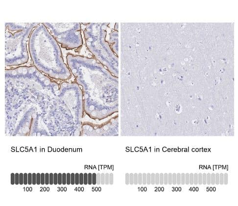 SGLT1/SLC5A1 Antibody SGLT1/SLC5A1 Antibody